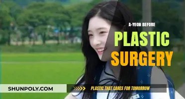 A-Yeon's Transformation: Unveiling Her Pre-Surgery Journey and Evolution