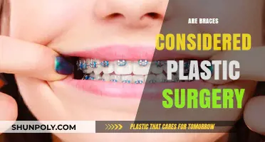 Are Braces Plastic Surgery? Debunking Myths About Orthodontic Treatment