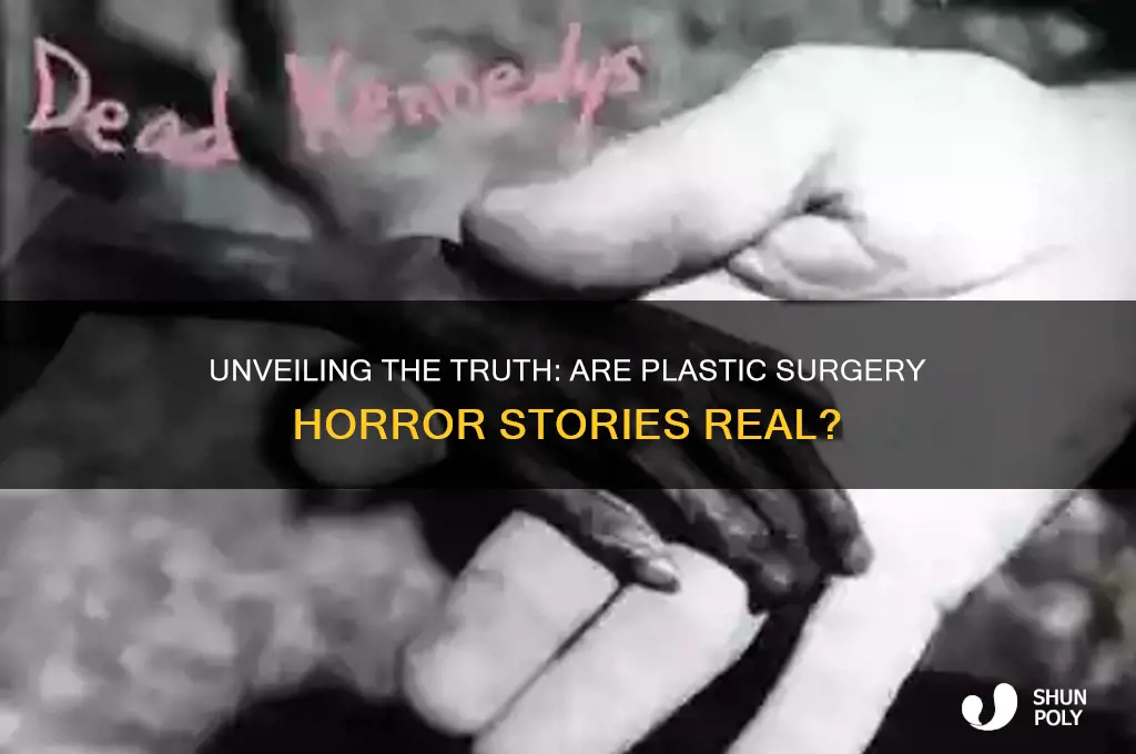 are plastic surgery horror stories true