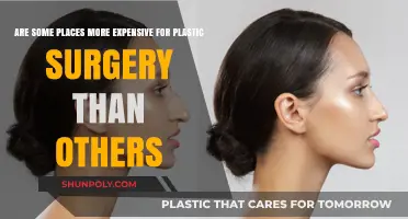Plastic Surgery Costs: Why Location Matters in Pricing Procedures