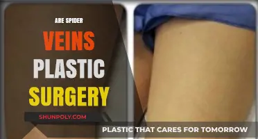 Spider Veins and Plastic Surgery: Treatment Options and Considerations