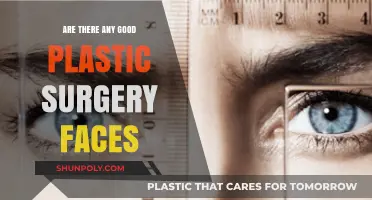Exploring the Aesthetics: Are There Truly Successful Plastic Surgery Faces?