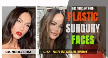 Plastic Surgery Faces: The Good, the Bad, and the Ugly