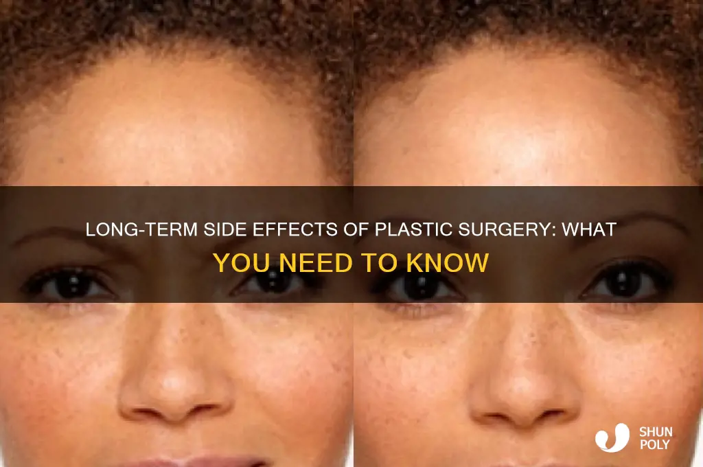 are there any long-term side effects of getting plastic surgery