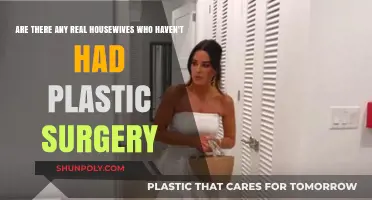 Real Housewives and Plastic Surgery: Who's Au Naturel?