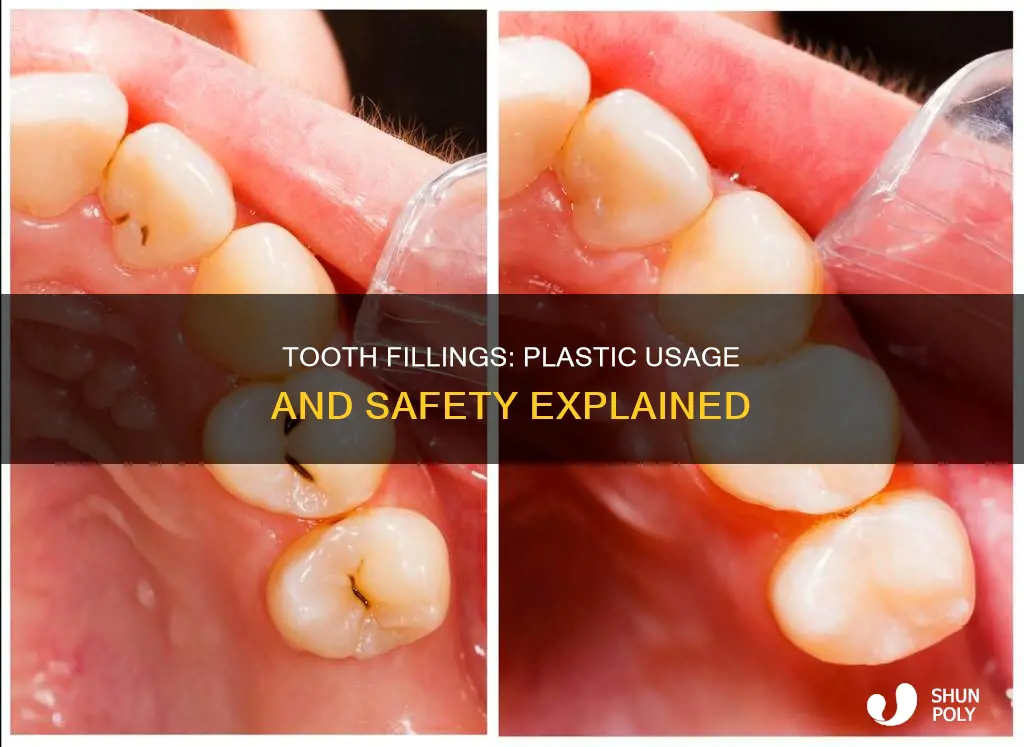 are tooth fillings suppose to be plastic