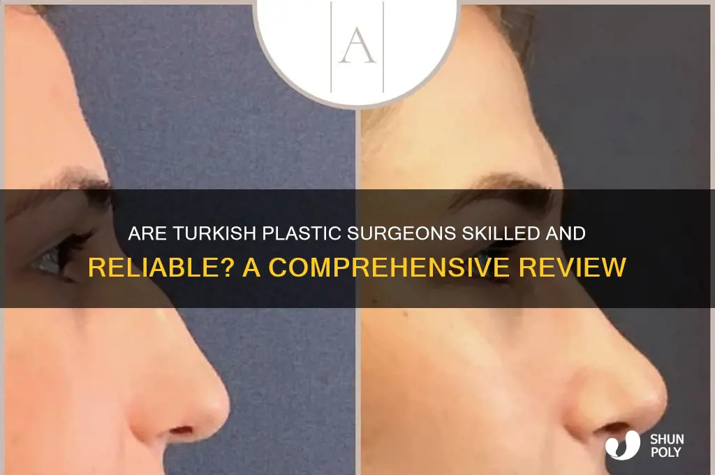 are turkish plastic surgeons good