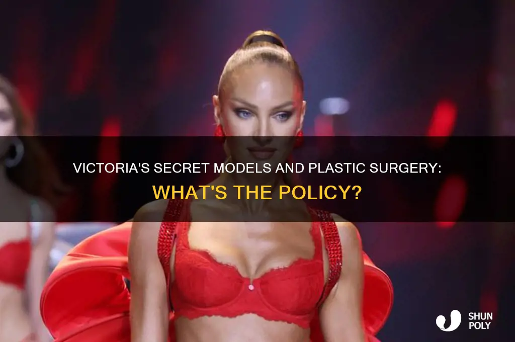 are victoria secret models allowed to have plastic surgery