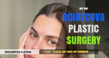 Viki Odintcova's Plastic Surgery: Fact or Fiction?