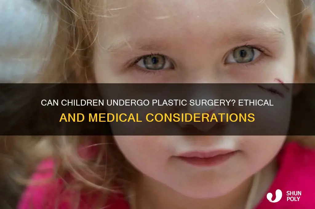 can a child get plastic surgery
