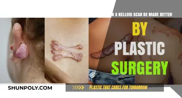 Improving Keloid Scars: Can Plastic Surgery Offer Effective Solutions?