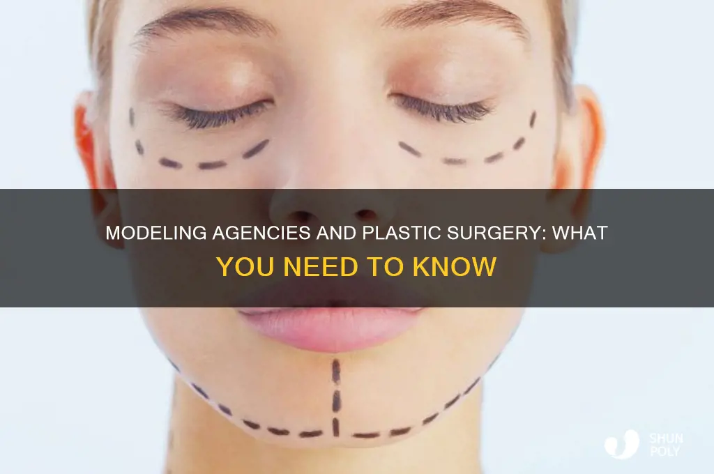 can a modeling agency get me plastic surgery