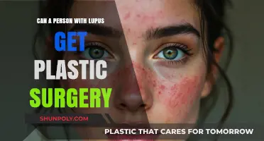 Lupus and Plastic Surgery: What Patients Need to Know