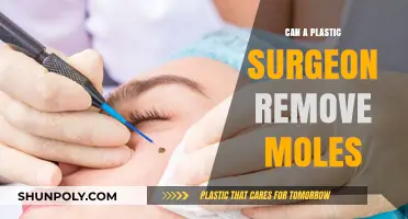 Mole Removal by Plastic Surgeons: Facts and Considerations