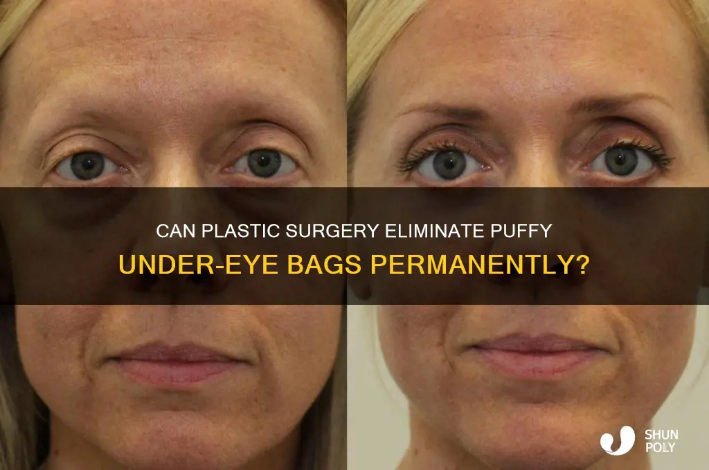 can a plastic surgery fix the puffy bags under eyes