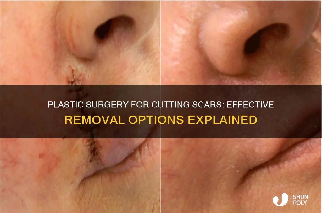can a plastic surgery get rid of cutting scars