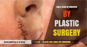 Can Plastic Surgery Effectively Remove Scars? Exploring Options and Outcomes