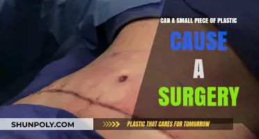 Small Plastic, Big Trouble: How a Tiny Piece Can Lead to Surgery