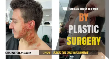 Healing Scars: Can Plastic Surgery Cure Acid Attack Injuries?