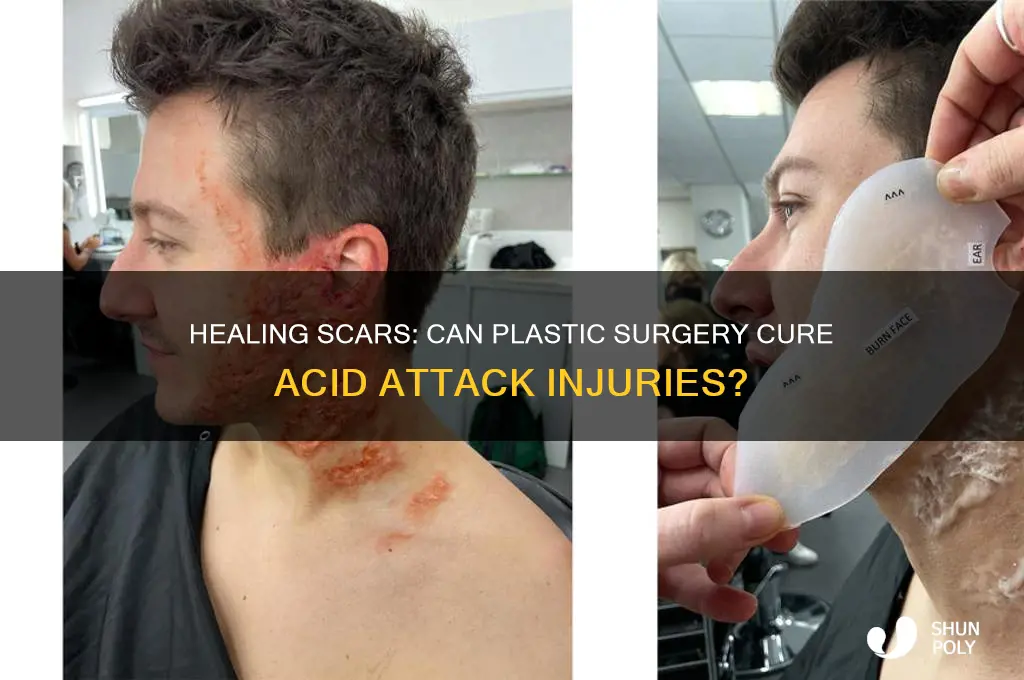 can acid attack be cured by plastic surgery