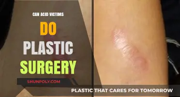 Healing Acid Attack Scars: Exploring Plastic Surgery Options for Victims