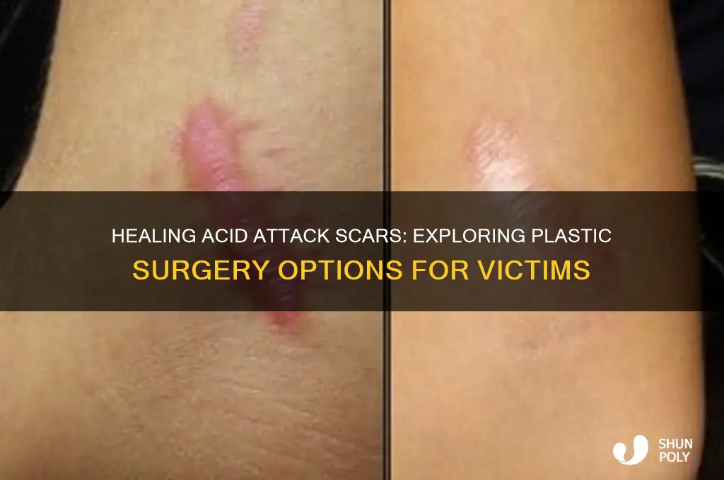 can acid victims do plastic surgery
