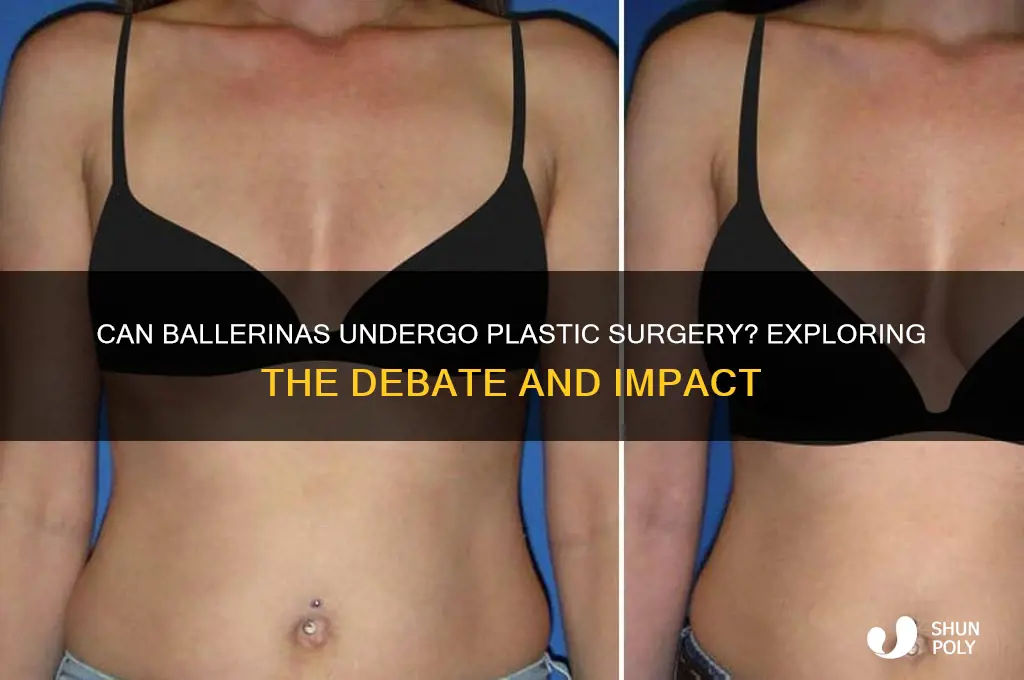 can ballerinas get plastic surgery