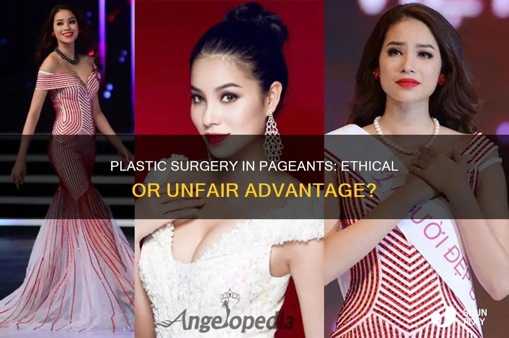 can beauty pageant contestants have plastic surgery