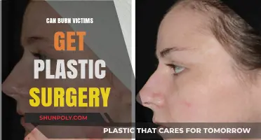 Plastic Surgery for Burn Victims: Healing Scars and Restoring Confidence