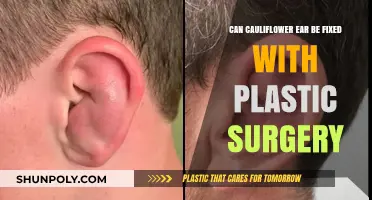 Can Plastic Surgery Repair Cauliflower Ear? Exploring Treatment Options
