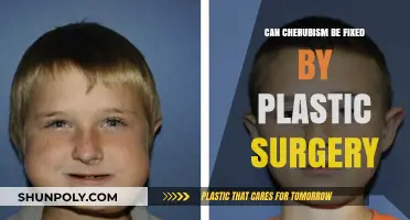 Can Plastic Surgery Correct Cherubism? Exploring Treatment Options and Outcomes