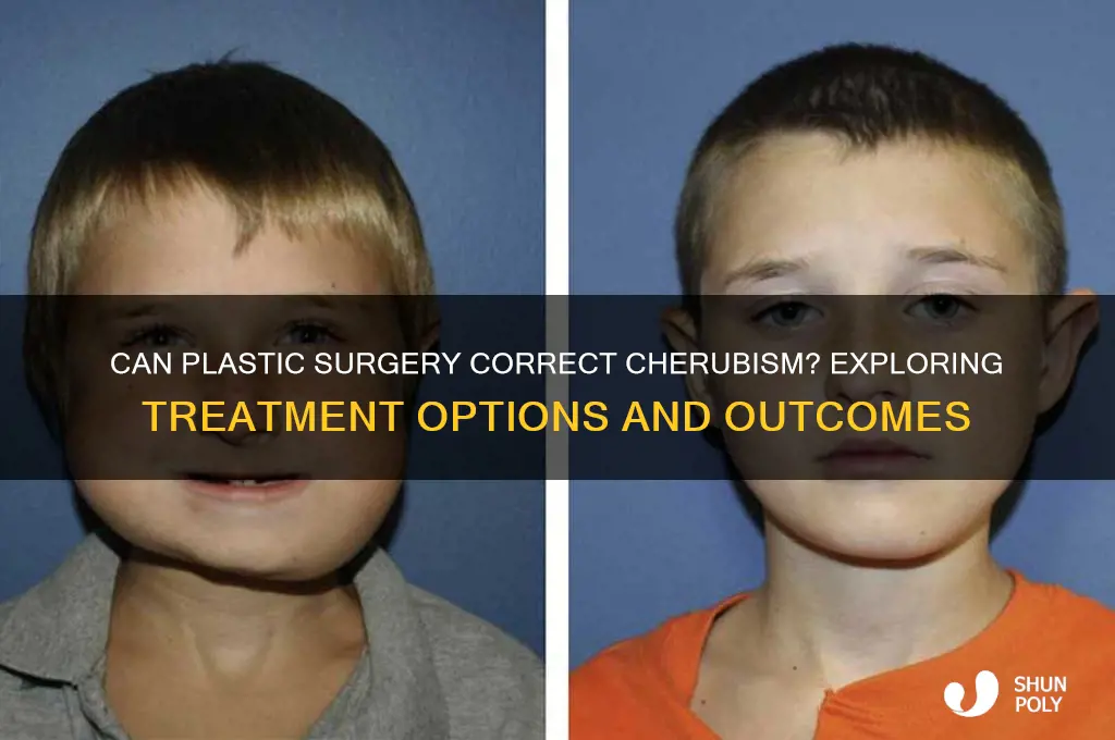 can cherubism be fixed by plastic surgery