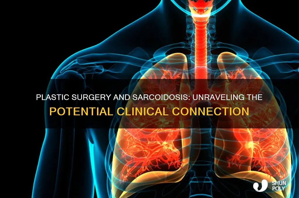 can clinical sarcoidosis be caused by plastic surgery