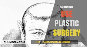 Can Criminals Use Plastic Surgery to Evade Justice?