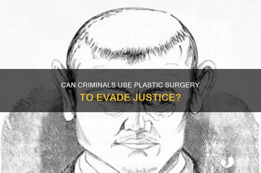 can criminals use plastic surgery