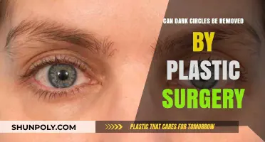 Can Plastic Surgery Effectively Remove Dark Circles? Expert Insights