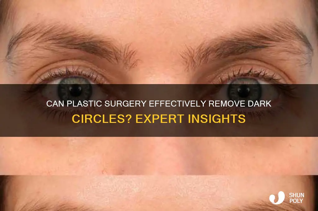 can dark circles be removed by plastic surgery