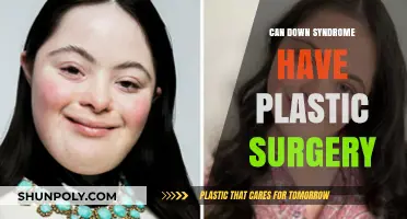 Exploring Plastic Surgery Options for Individuals with Down Syndrome