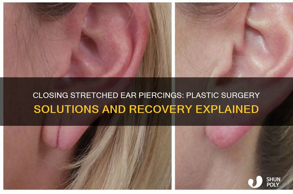 can ear piercing be closed with plastic surgery