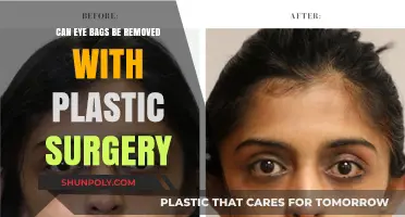 Can Plastic Surgery Effectively Remove Eye Bags? Expert Insights