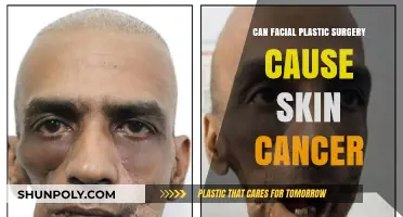 Facial Plastic Surgery and Skin Cancer: Uncovering the Potential Risks