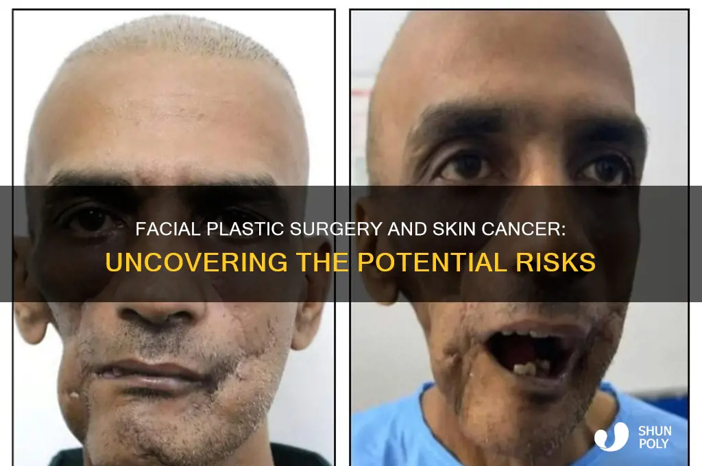 can facial plastic surgery cause skin cancer