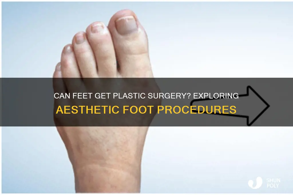can feet get plastic surgery
