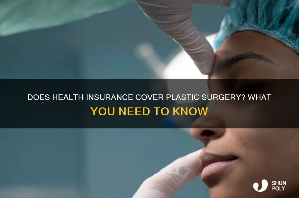 can health insurance cover plastic surgery