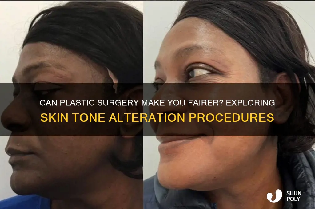 can i become fair by plastic surgery