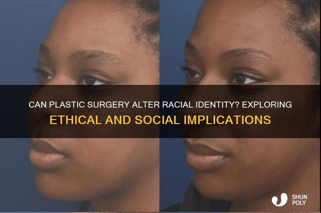 can i change my race throught plastic surgery