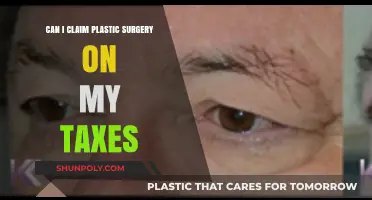 Tax Deductions for Plastic Surgery: What You Need to Know