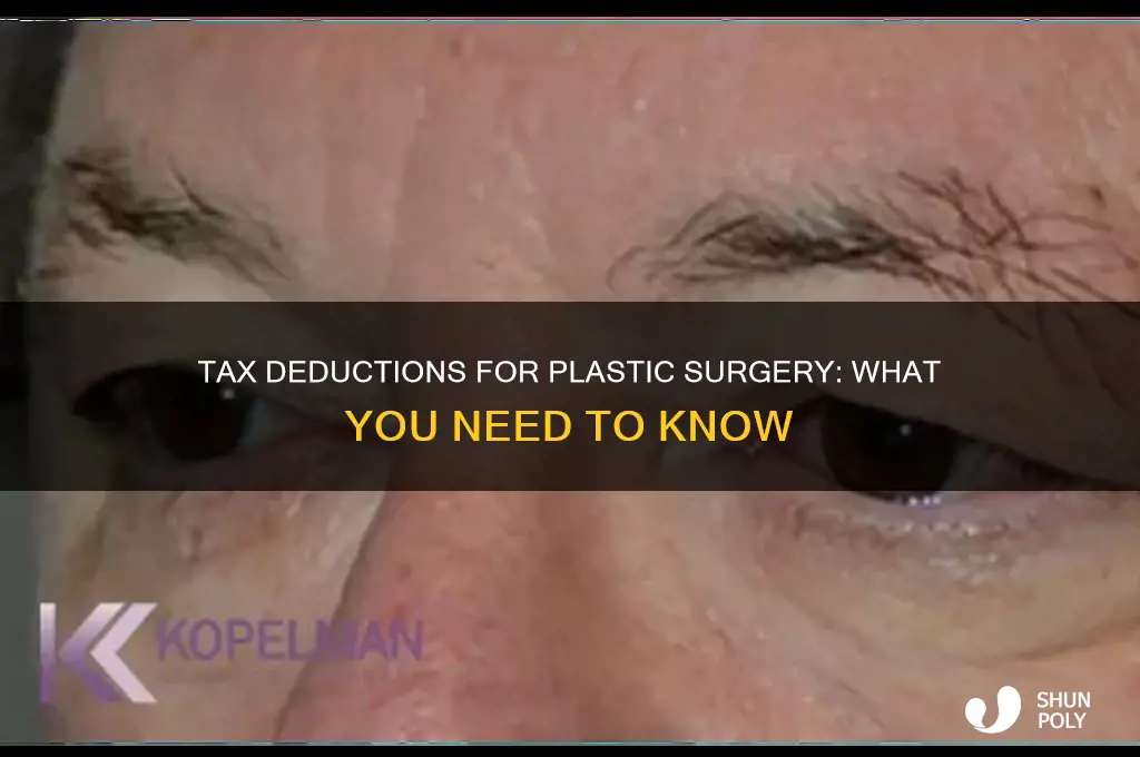 can i claim plastic surgery on my taxes