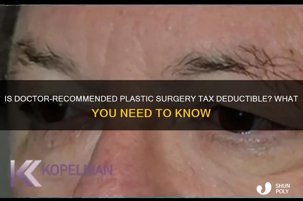 can i deduct doctor recommend plastic surgery