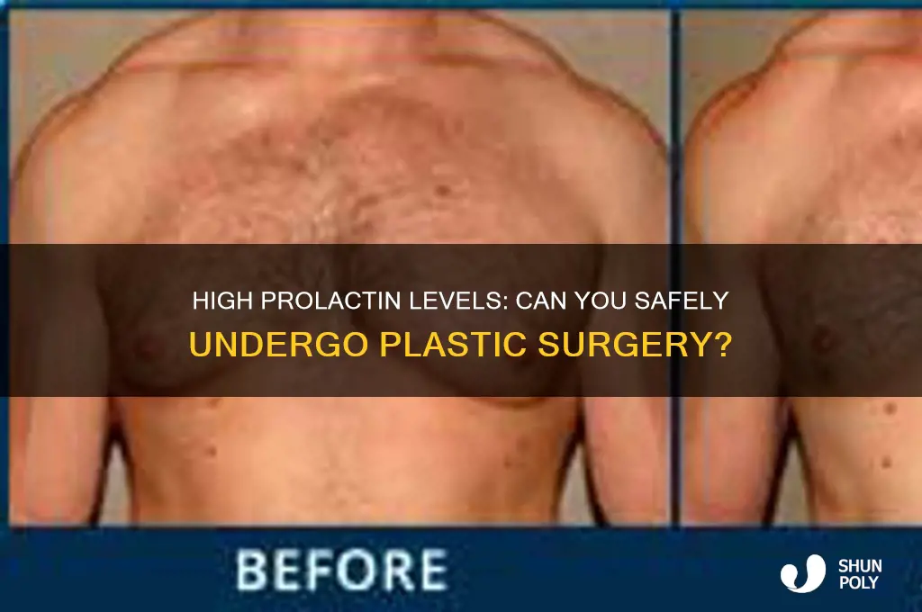 can i do plastic surgery with high prolactin